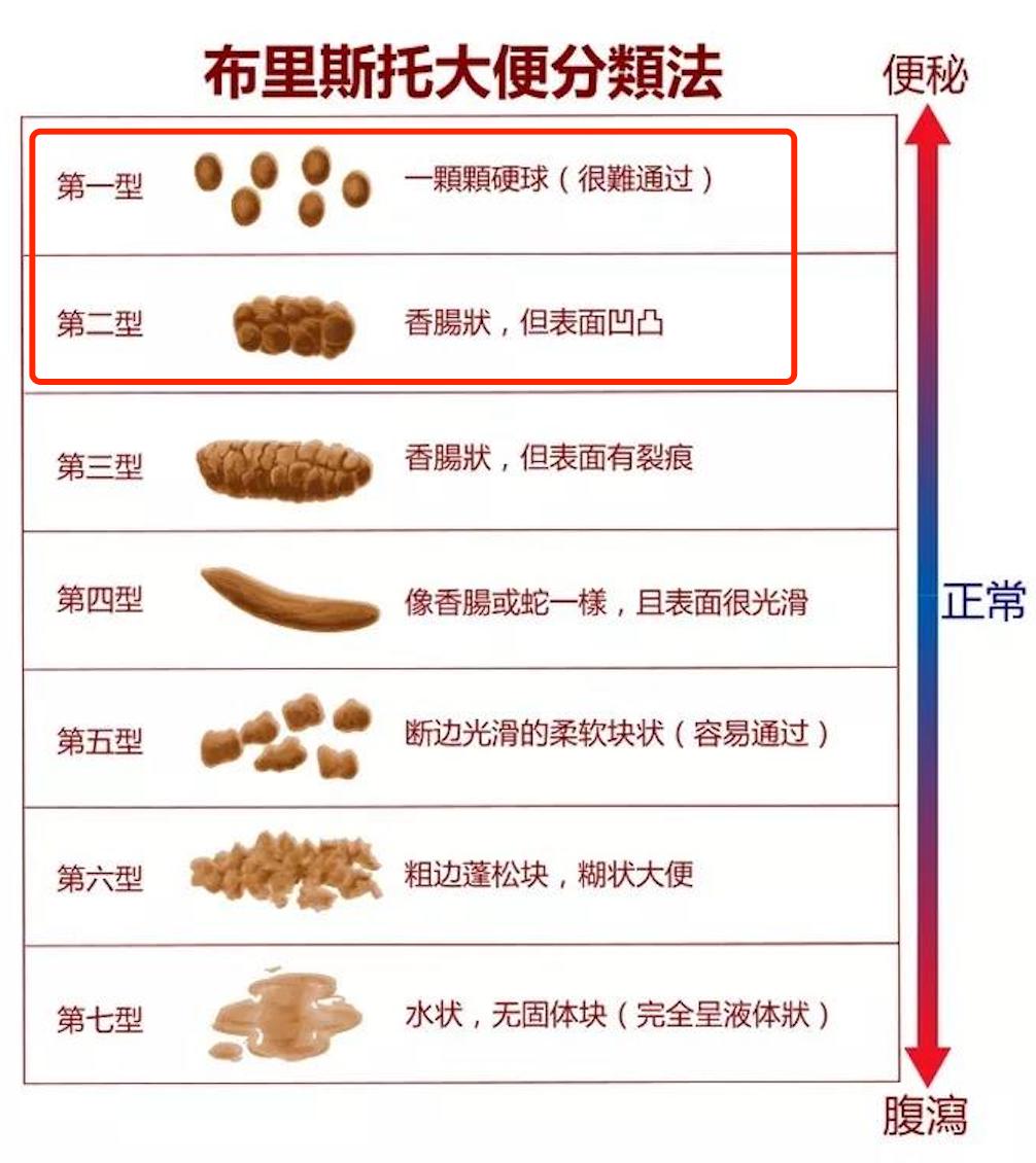 半个月不大便怎么回事探究半个月不大便的原因及其解决方法